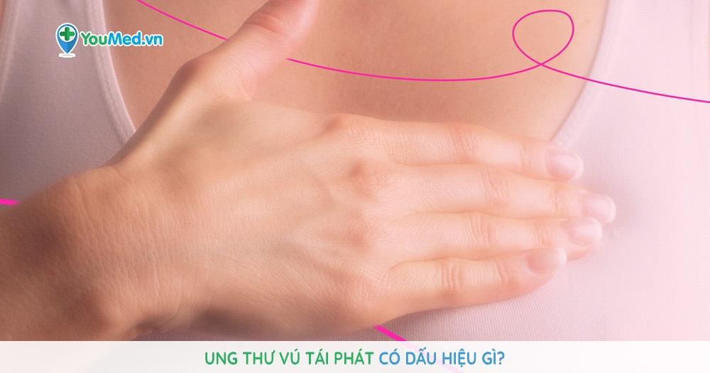 Ung thư vú tái phát có dấu hiệu gì?