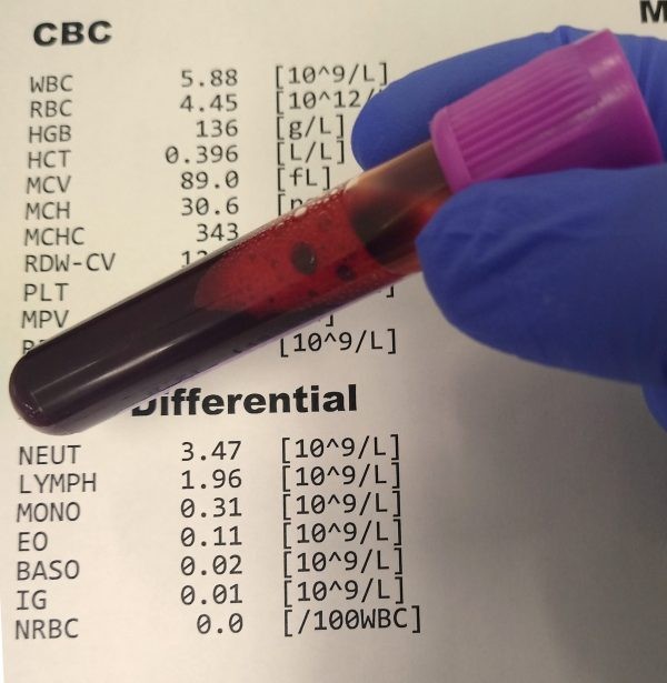 xét nghiệm máu trong thời gian thai kỳ