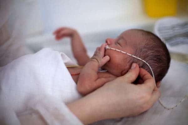 bé sinh non có nguy cơ suy hô hấp do xẹp phổi