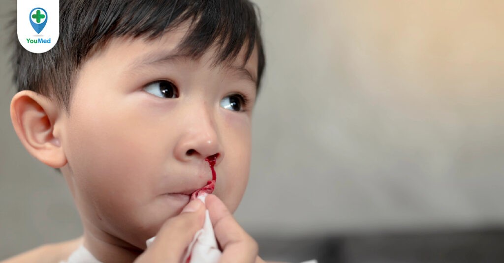 Nguyên nhân và cách chữa trị chảy máu cam ở trẻ em hiệu quả