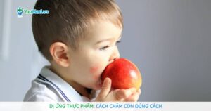 Dị ứng thực phẩm: Cách chăm con đúng cách