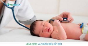 Lồng ruột: nguyên nhân, triệu chứng và cách điều trị