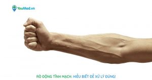 Rò động tĩnh mạch: nguyên nhân, triệu chứng và cách điều trị