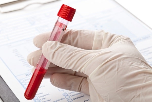Mẫu máu được lấy để xét nghiệm tìm liên cầu nhóm B