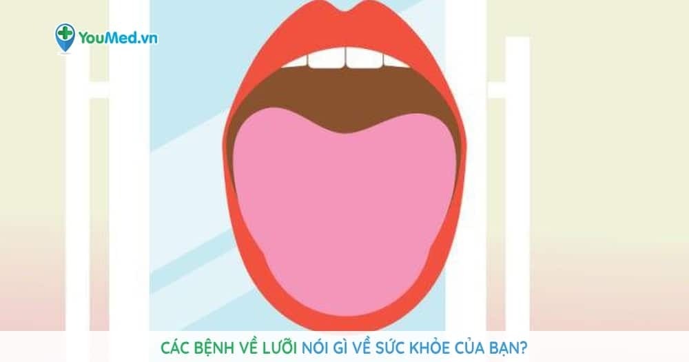Các bệnh về lưỡi nói gì về sức khỏe của bạn