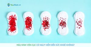 Máu kinh vón cục có nguy hiểm đến sức khoẻ không?