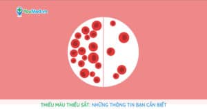 Thiếu máu thiếu sắt: Những thông tin bạn cần biết