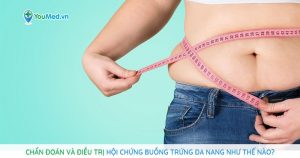 Hội chứng buồng trứng đa nang: chẩn đoán và điều trị như thế nào?