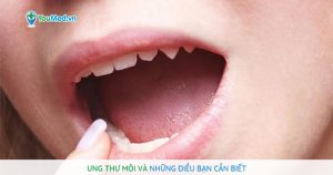 Ung thư môi: nguyên nhân, biểu hiện và cách điều trị