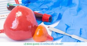 Lộ bàng quang và những điều cần biết