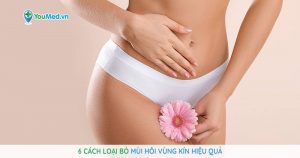 6 cách loại bỏ mùi hôi vùng kín hiệu quả