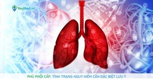 Phù phổi cấp: Tình trạng nguy hiểm cần đặc biệt lưu ý