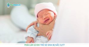 Phải làm gì khi trẻ sơ sinh bị nấc cụt?