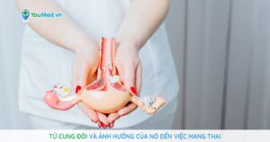 Tử cung đôi và ảnh hưởng của nó đến việc mang thai