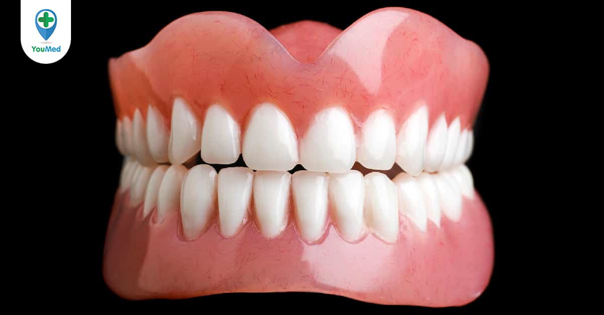 Những bộ răng tốt nhất để điều trị răng miệng hư hỏng là gì?