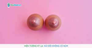 Hiện tượng kỳ lạ: Núi đôi không có núm