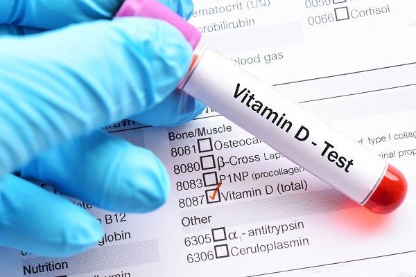 Kiểm tra lượng vitamin D thông qua nồng độ 25(OH)D trong huyết thanh