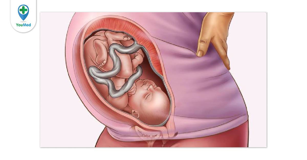 Có những biện pháp nào để giảm các triệu chứng không thoải mái khi mang thai ở tuần thứ 36?
