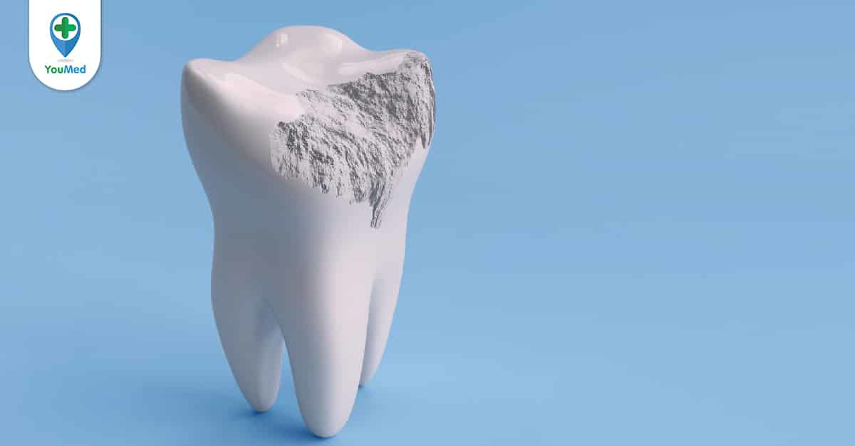 Răng được cấu tạo từ những thành phần nào?
