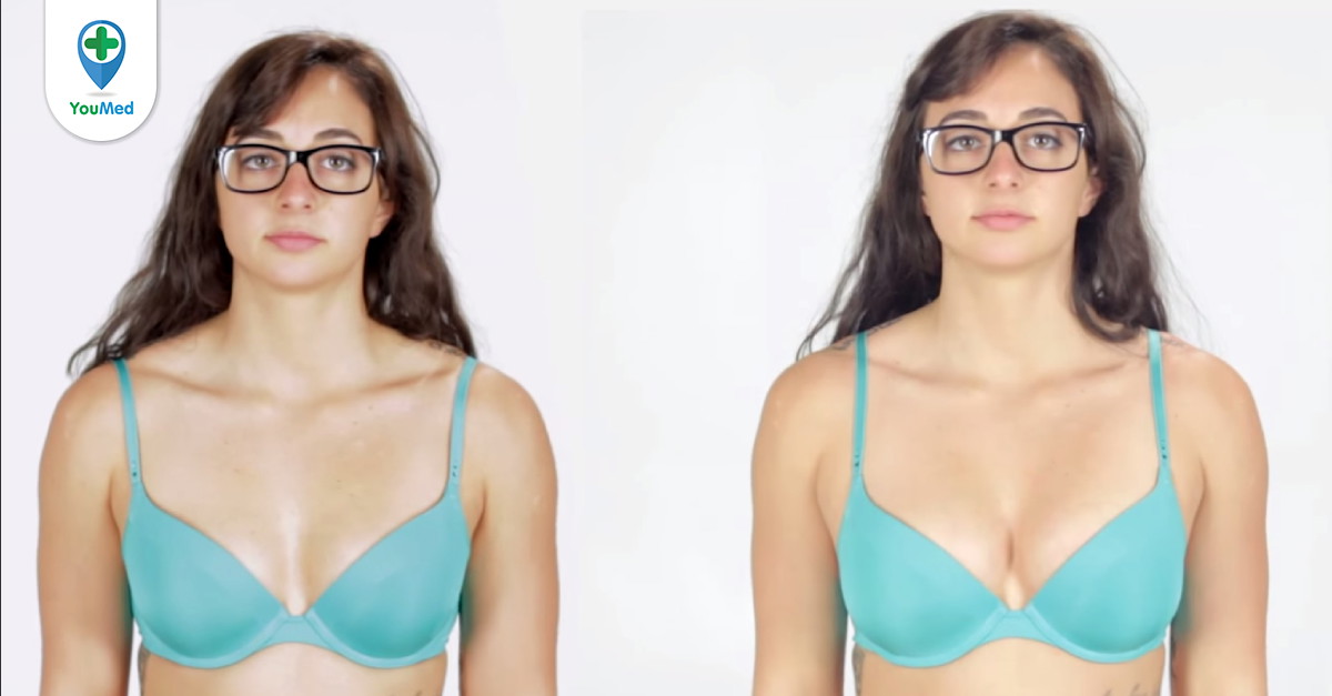 Tại sao ngực một bên trở nên to bất thường?
