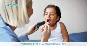 Viêm họng ở trẻ em và những điều cần biết