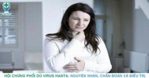 Hội chứng phổi do virus Hanta: Nguyên nhân, chẩn đoán và điều trị