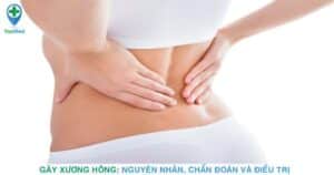 Gãy xương hông: Nguyên nhân, chẩn đoán và điều trị