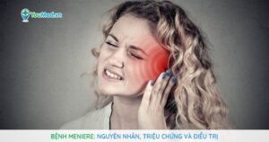 Bệnh Meniere: Nguyên nhân, triệu chứng và cách điều trị