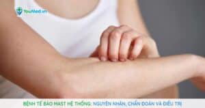 Bệnh tế bào mast hệ thống: nguyên nhân, chẩn đoán và điều trị