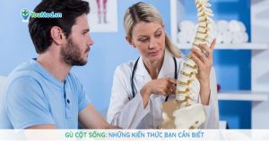 Gù cột sống: Những kiến thức bạn cần biết