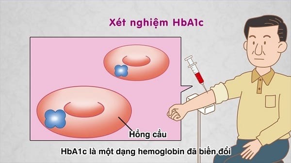 HbA1c là một dạng hemoglobin đã biến đổi, đo lường từ máu lấy ở tĩnh mạch