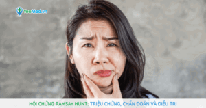 Hội chứng Ramsay Hunt: triệu chứng, chẩn đoán và điều trị