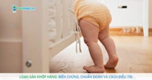 Loạn sản khớp háng và những điều cần biết