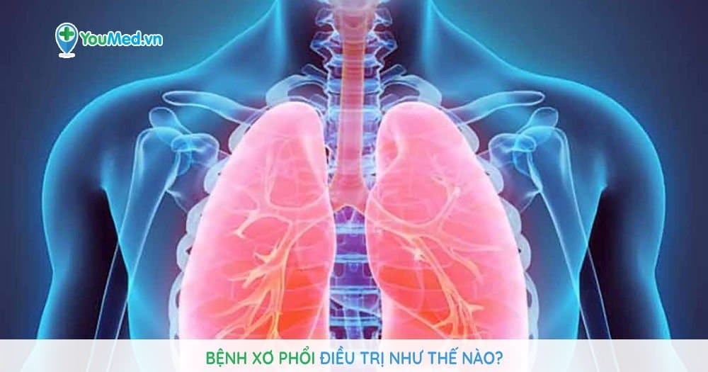 Bệnh xơ phổi điều trị như thế nào?