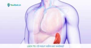 Lá lách to: Có nguy hiểm hay không?