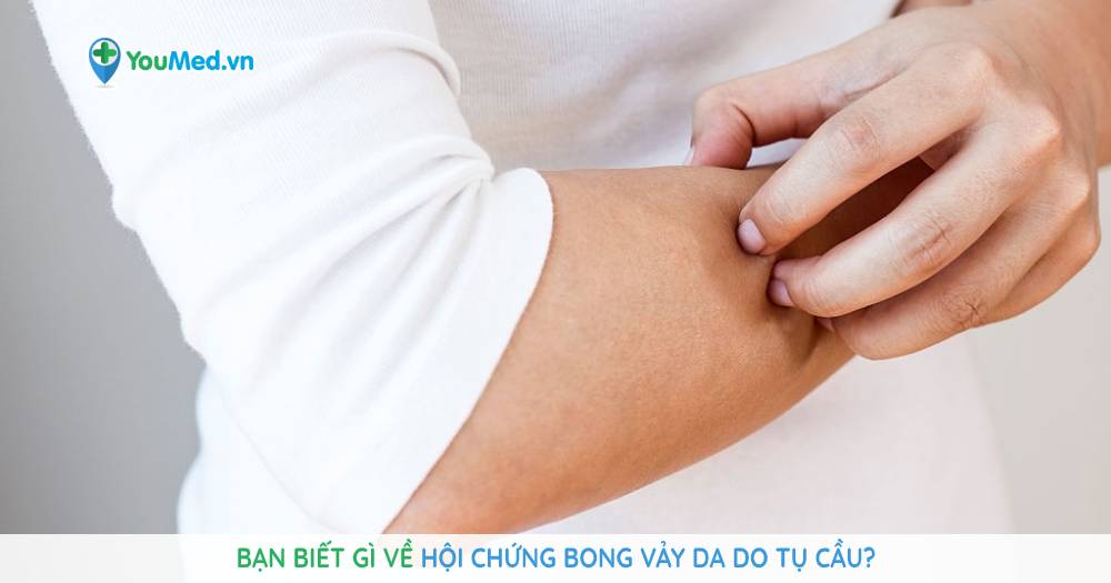 Bạn biết gì về Hội chứng bong vảy da do tụ cầu?