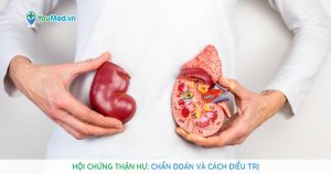 Hội chứng thận hư: phương pháp chẩn đoán và điều trị