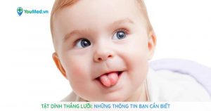 Tật dính thắng lưỡi: những thông tin bạn cần biết