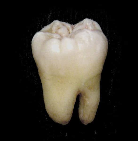 Hình thể các răng hàm dưới