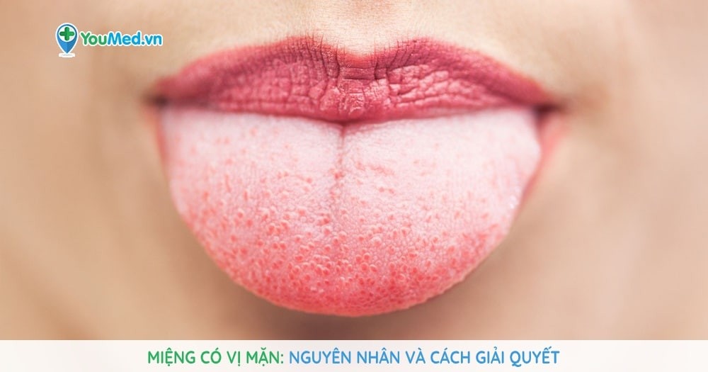 Miệng có vị mặn: Nguyên nhân và cách giải quyết