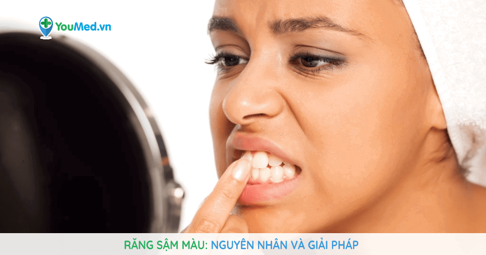 Răng sậm màu: Nguyên nhân và giải pháp!