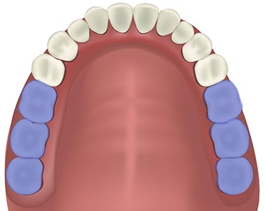 răng cối lớn 