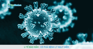 U tế bào mầm có phải bệnh lý nguy hiểm