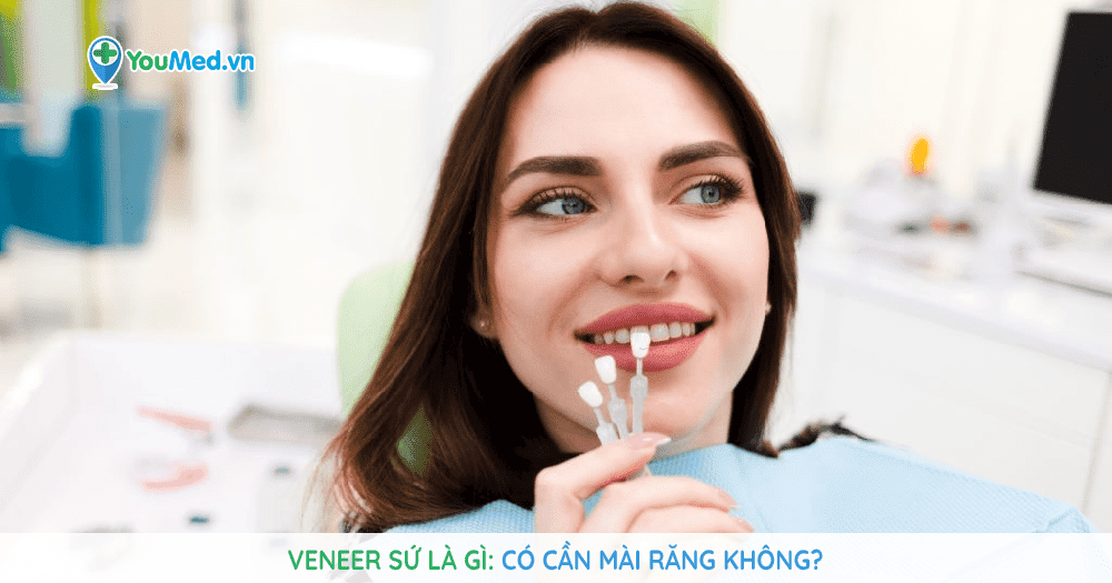 Veneer sứ là gì? Có cần mài răng không?