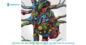 Viêm nội tâm mạc nhiễm trùng: nguy cơ mắc phải và dự phòng