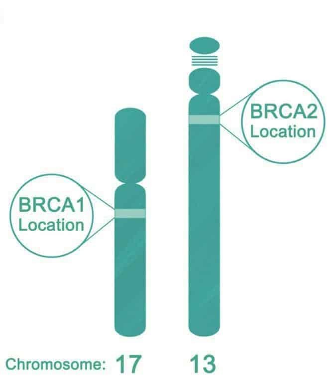 Vị trí gen BRCA 1 và 2