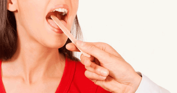 Chẩn đoán bệnh cứng lưỡi