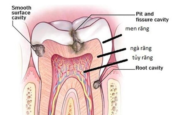 Cấu tạo của răng