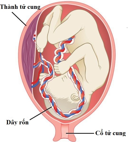 dây rốnBa mạch máu từ dây rốn được bao bọc bởi Wharton’s jelly