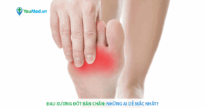 Đau xương đốt bàn chân và những lưu ý khi điều trị!